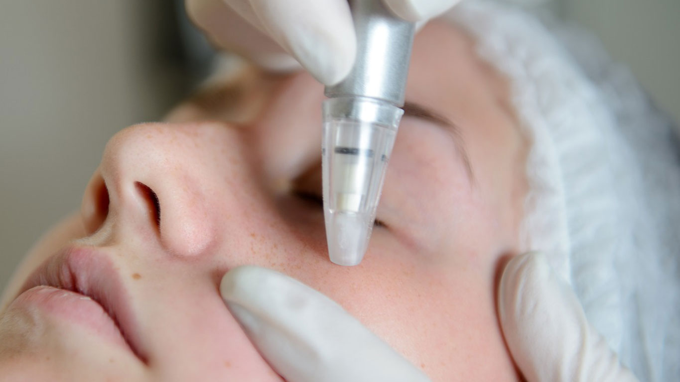 Micro-dermabrasion Best You Training