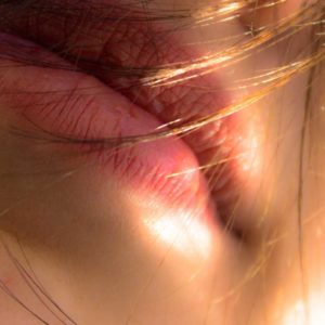 Dermal Fillers – Lips Refresher