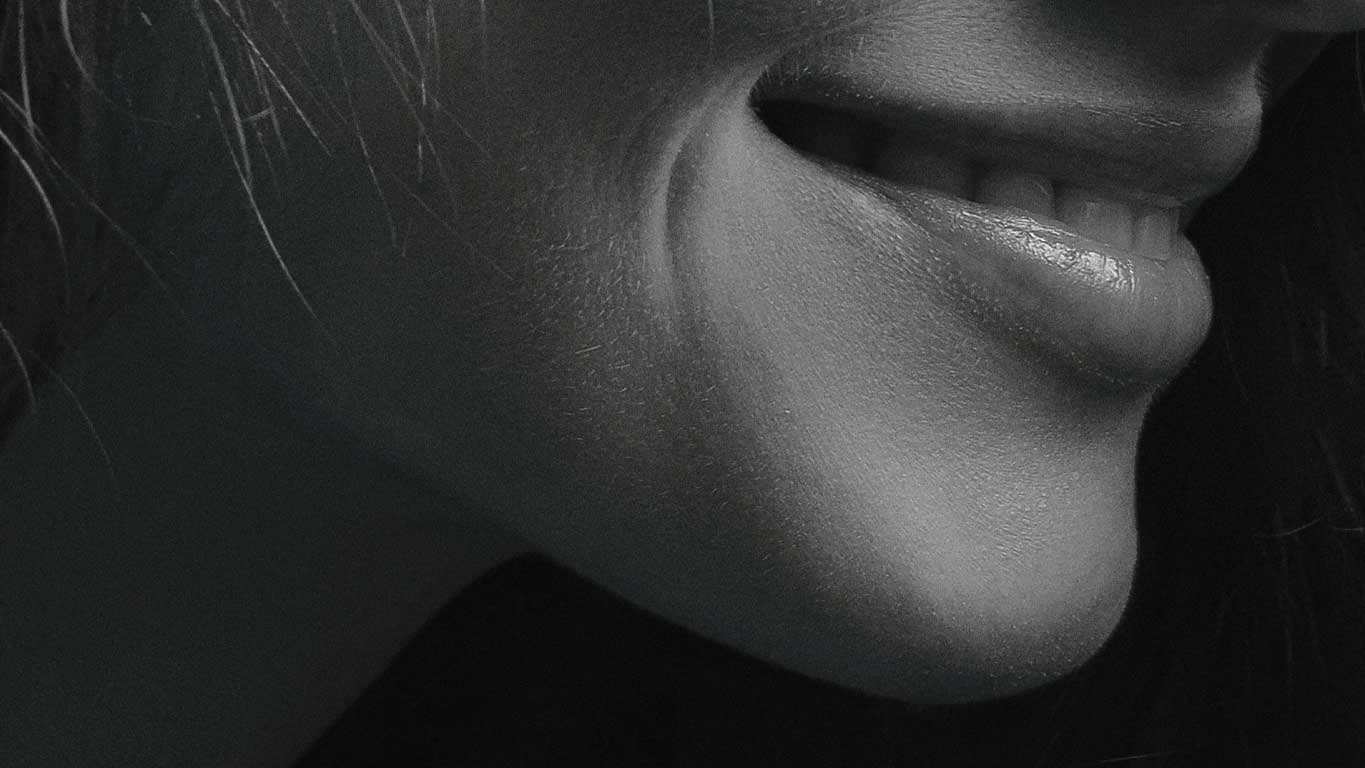 Advanced Dermal Fillers - Cheekbone Refresher Course