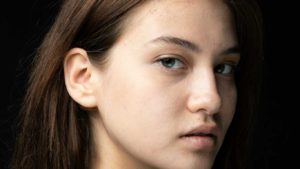 Advanced Dermal Fillers - Non-Surgical Rhinoplasty Refresher Course