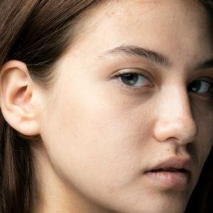 Advanced Dermal Fillers - Non-Surgical Rhinoplasty Refresher Course