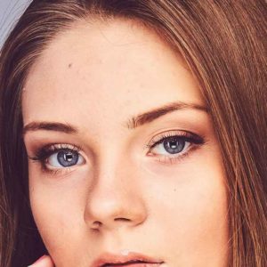 Advanced Dermal Fillers - Tear Trough Refresher