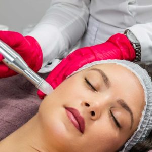 VTCT (ITEC) Level 4 Microneedling Training Course