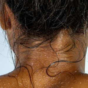 VTCT Skills (iTEC) Level 4 Diploma in Advanced Aesthetic Treatments