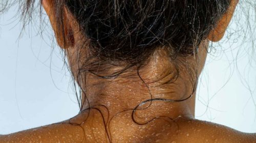 VTCT Skills (iTEC) Level 4 Diploma in Advanced Aesthetic Treatments